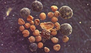 Under a microscope, a tiny elongate poppy seed, small tan spikemoss megaspores and black soil fungus spheres found in soil recovered from under 2 miles of Greenland’s ice. Halley Mastro/University of Vermont, CC BY-ND